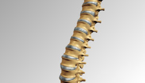 Read more about the article Leading Thoracic Spine Surgeons in the World