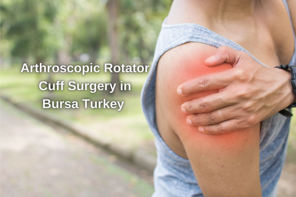 Arthroscopic Rotator Cuff Surgery in Bursa Turkey