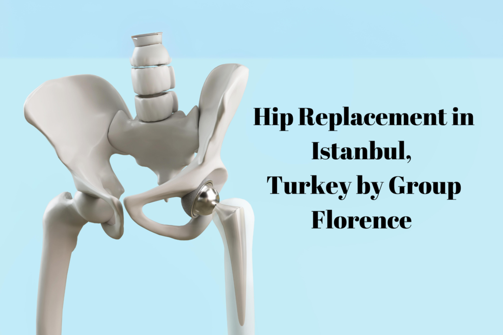 Hip Replacement in Istanbul, Turkey by Group Florence