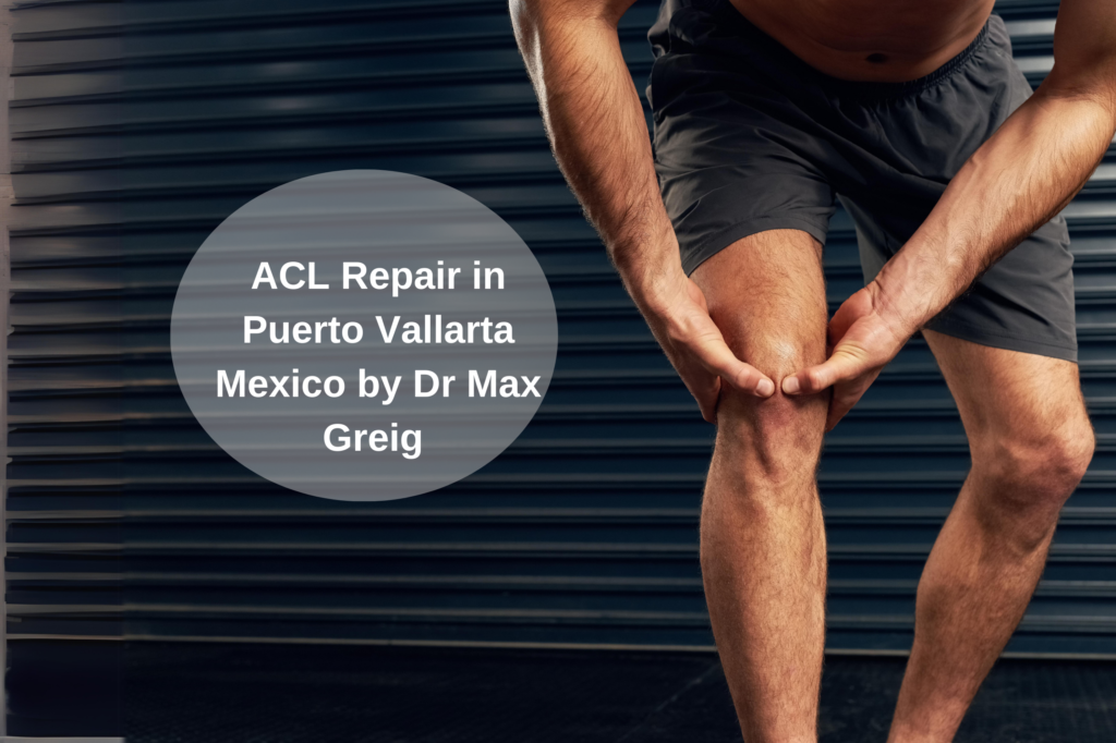 ACL Repair in Puerto Vallarta Mexico by Dr Max Greig