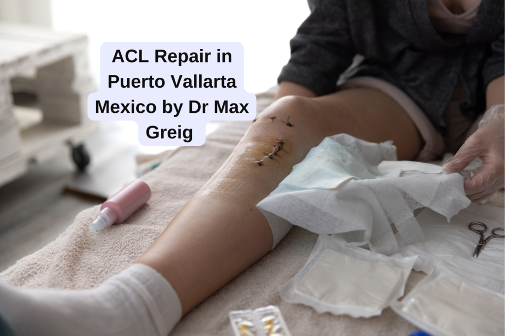 ACL Repair in Puerto Vallarta Mexico by Dr Max Greig