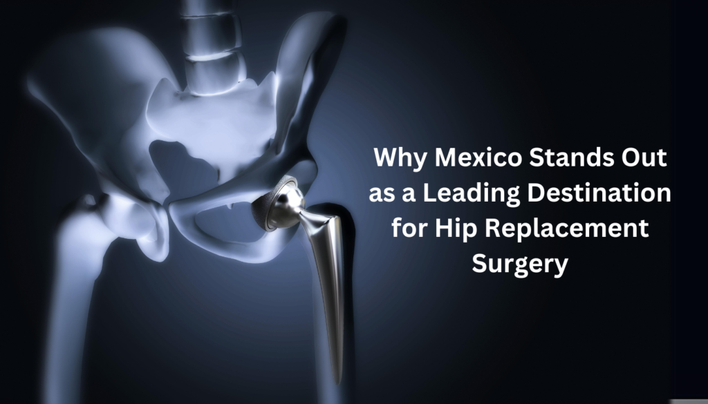 Why Mexico Stands Out as a Leading Destination for Hip Replacement Surgery