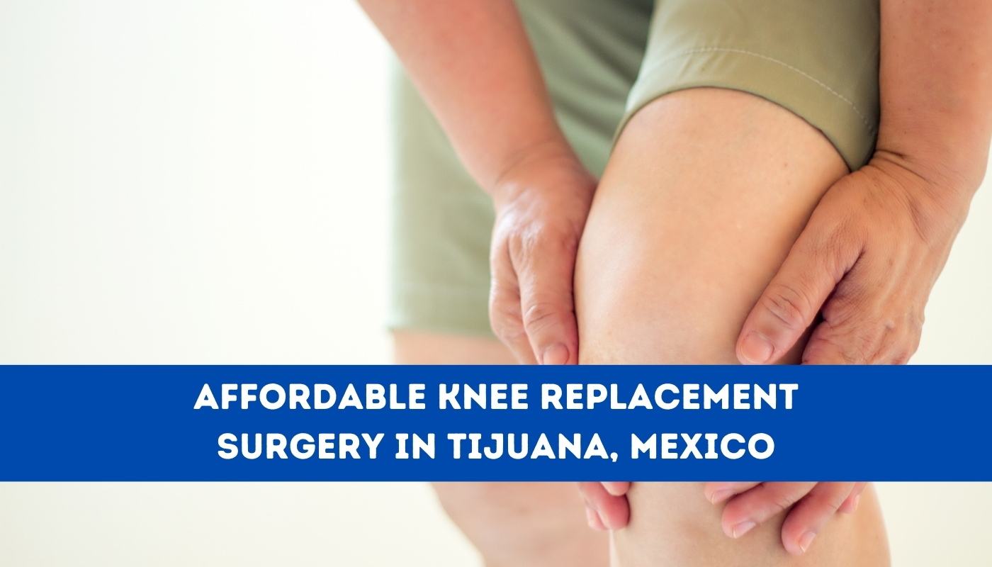 Affordable Knee Replacement Surgery in Tijuana, Mexico