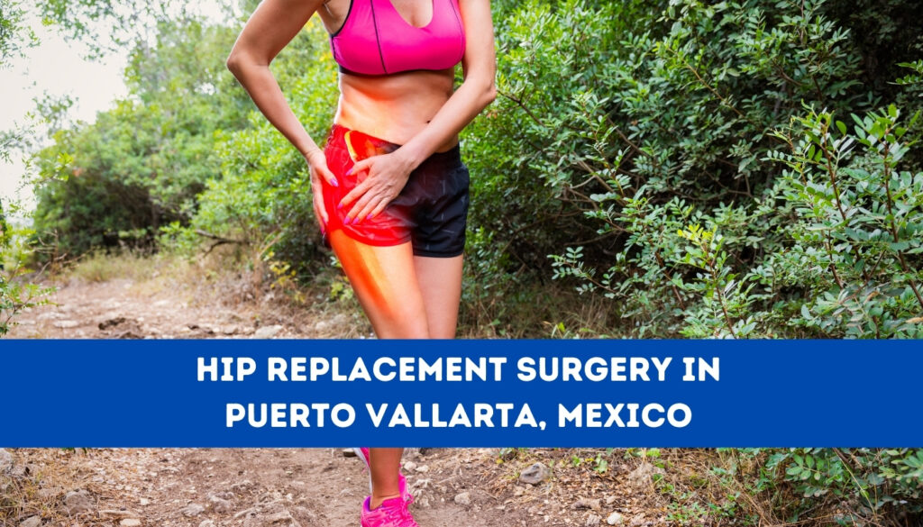 Hip Replacement Surgery in Puerto Vallarta, Mexico