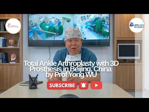 Total Ankle Arthroplasty with 3D Prosthesis in Beijing, China by Prof Yong WU