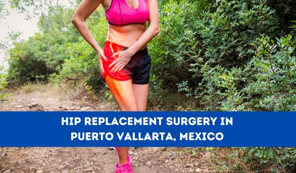 Hip Replacement Surgery in Puerto Vallarta, Mexico