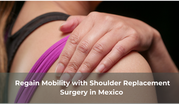 Regain Mobility with Shoulder Replacement Surgery in Mexico 