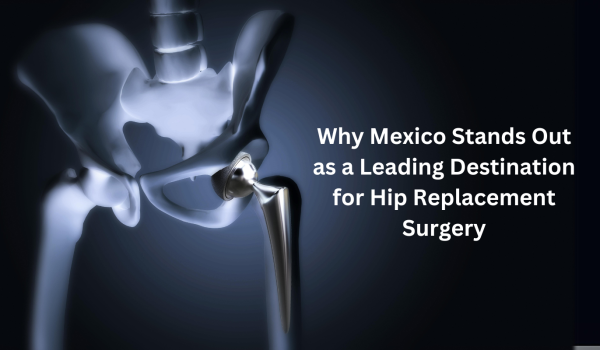 Why Mexico Stands Out as a Leading Destination for Hip Replacement Surgery